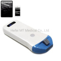 Mt Medical Newest Portable 128 Elements Wireless Ultrasound Probe